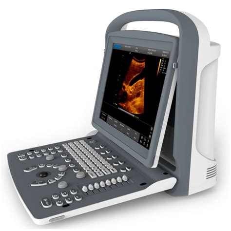 chison ultrasound machine